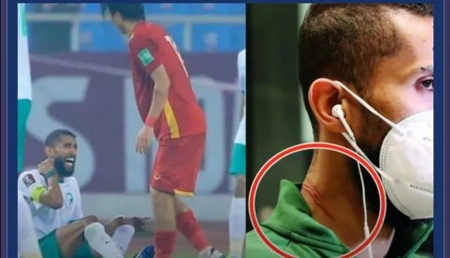 271865260 4641983392516234 3225030760561614170 N E1642057519461